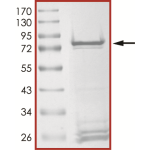 MET (Y1230A), Active